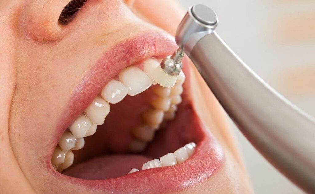 Beneficios de una limpieza bucal cada seis meses